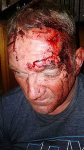 Pretoria man word nog 'n statistiek van taxi geweld na aanval met baksteen